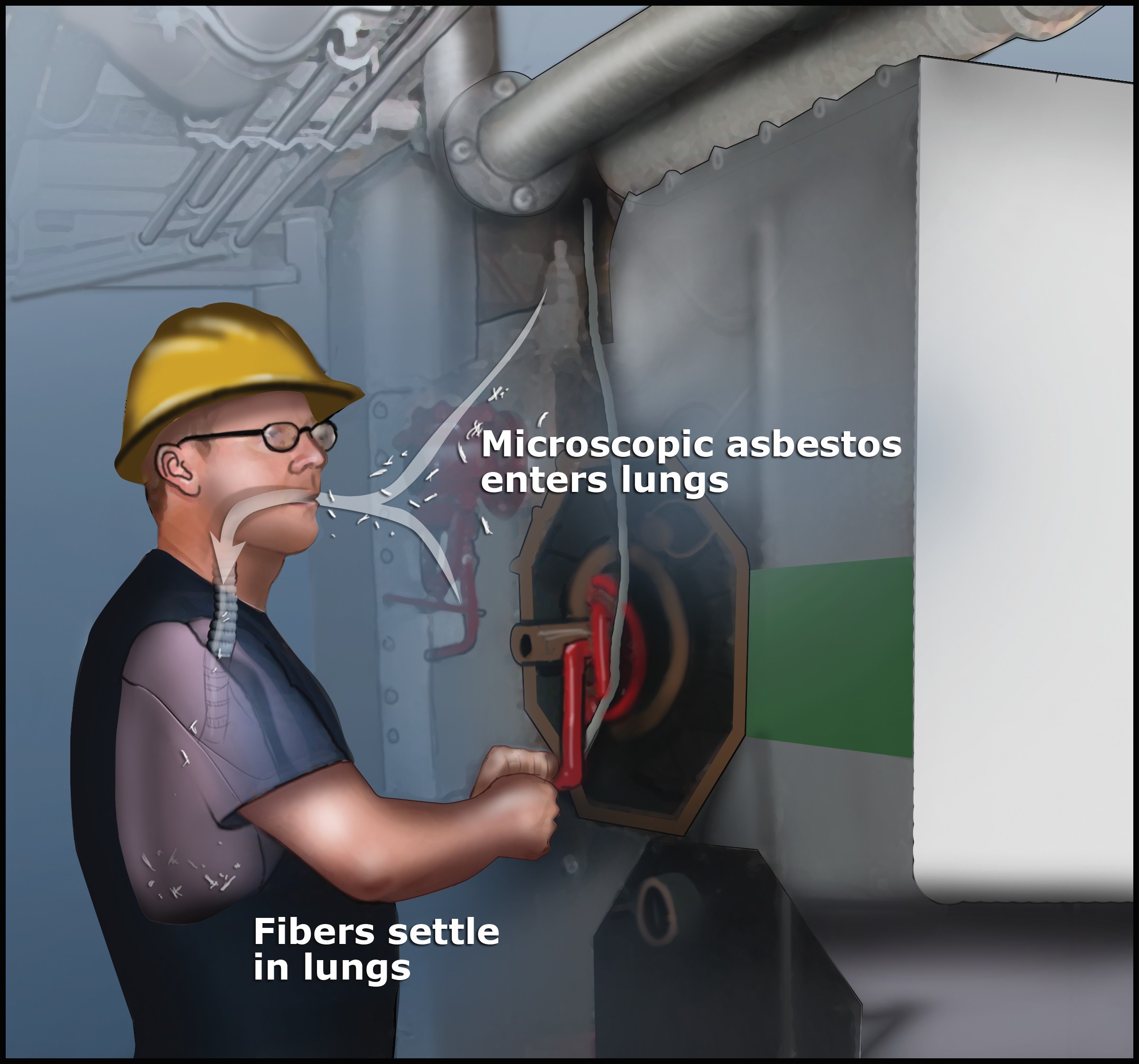 asbestos exposure